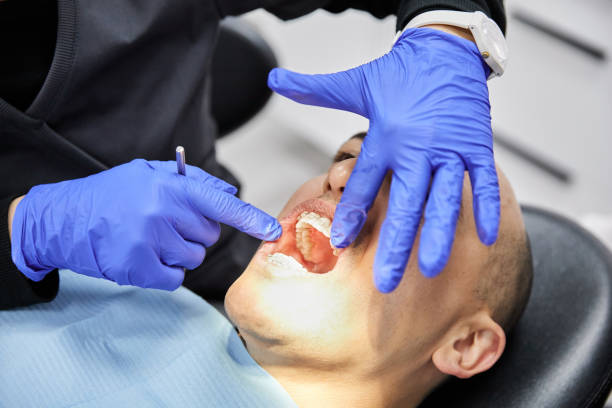 Best Emergency Dentist for Knocked-Out Tooth in Lincoln, ND